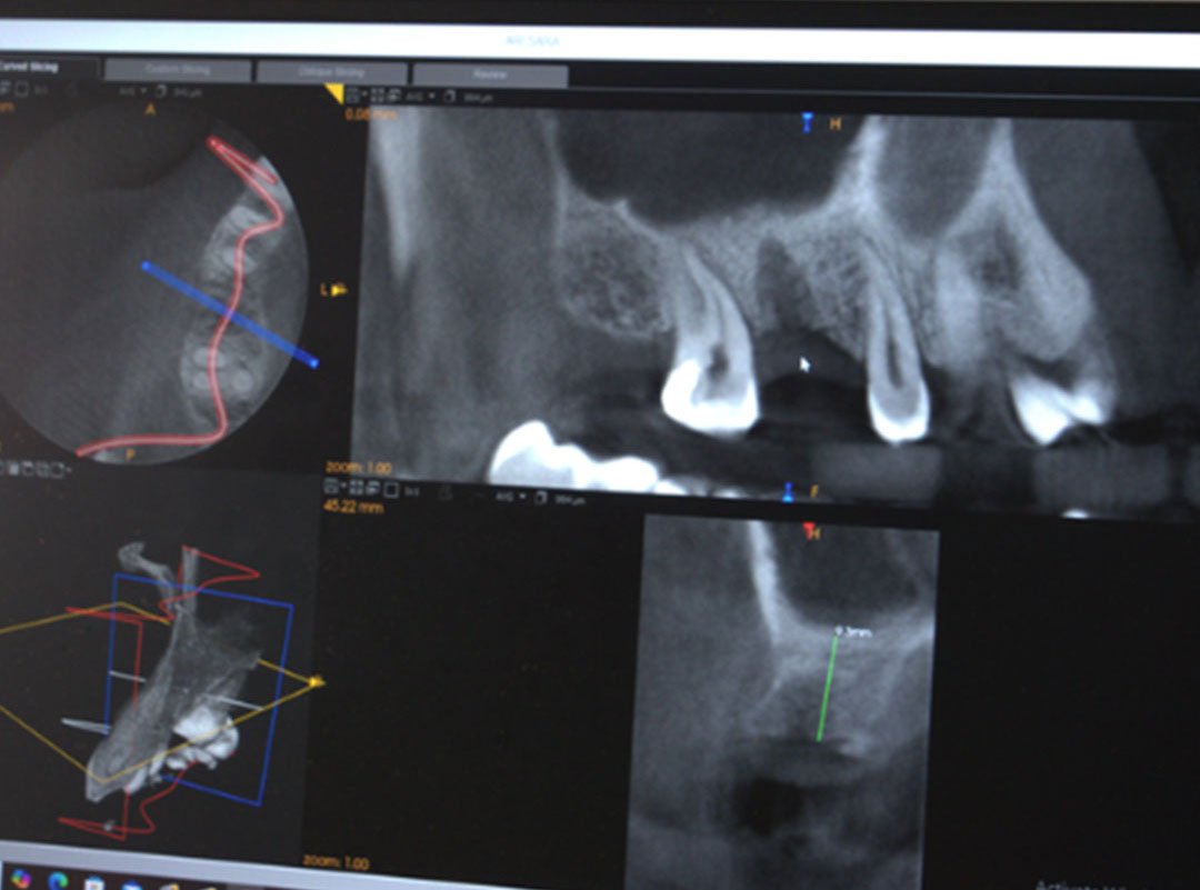 digital-radiography