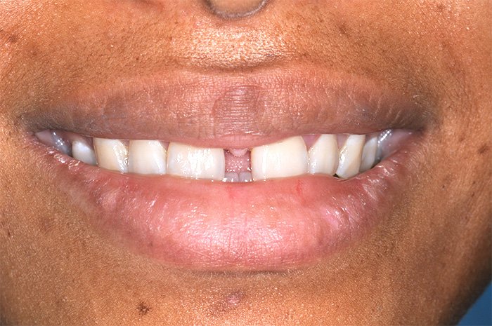 e-chantier-dental-clinic-dental-services-before-n-after-img