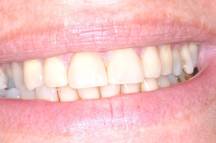 le-chantier-dental-clinic-dental-services-before-n-after-img