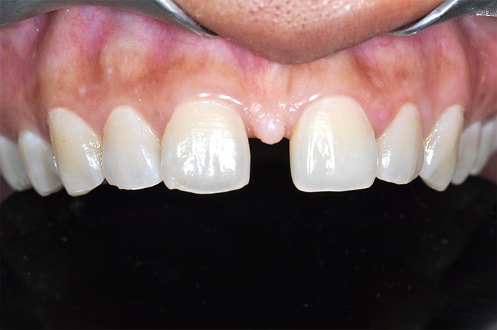 e-chantier-dental-clinic-dental-services-before-n-after-img