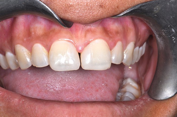 e-chantier-dental-clinic-dental-services-before-n-after-img