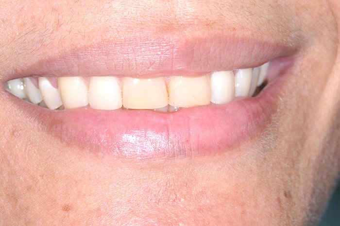 le-chantier-dental-clinic-dental-services-before-n-after-img