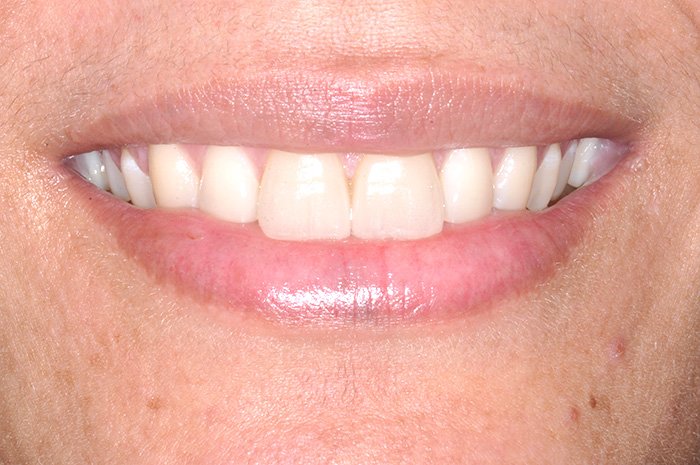 le-chantier-dental-clinic-dental-services-before-n-after-img