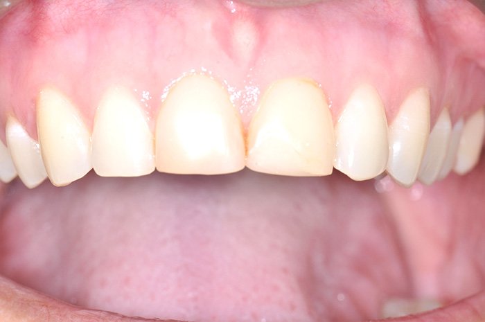le-chantier-dental-clinic-dental-services-before-n-after-img