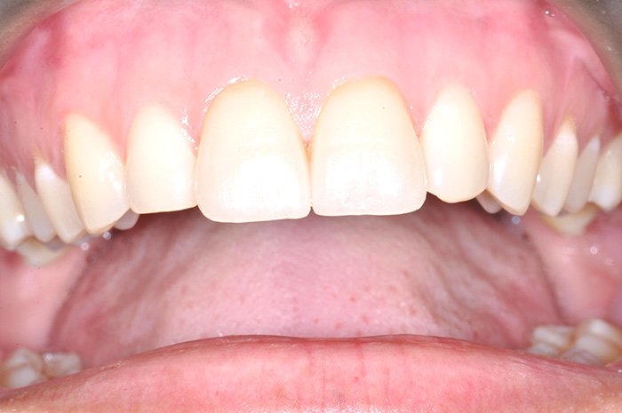 le-chantier-dental-clinic-dental-services-before-n-after-img