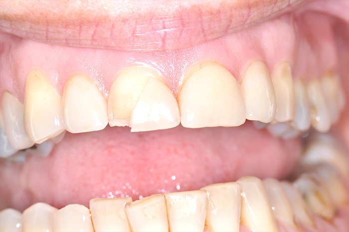 le-chantier-dental-clinic-dental-services-before-n-after-img